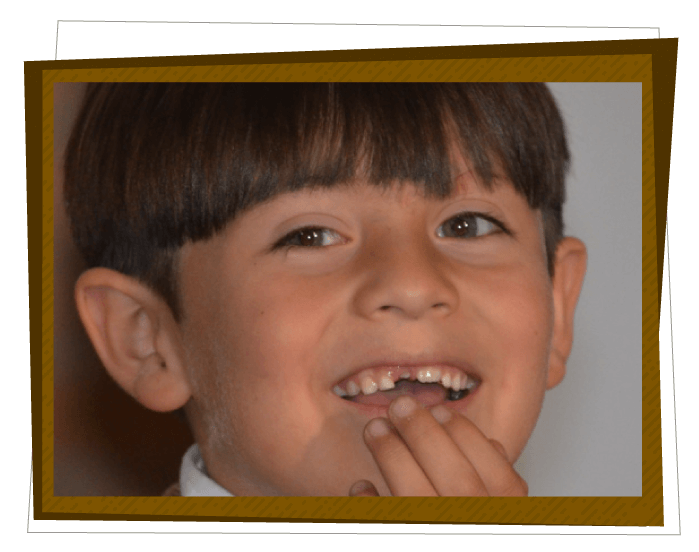Claves Alharaca